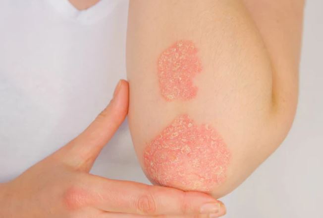 Descriptive Title Text Descriptive Alt Text